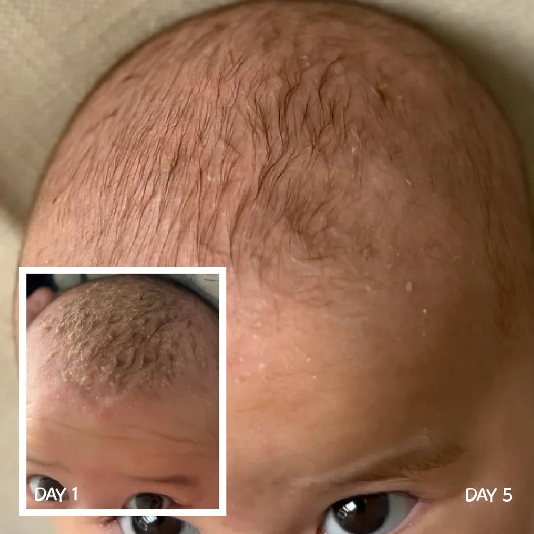 MooGoo Scalp Cream 120g
